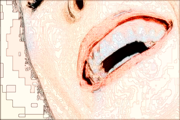 上海曙光醫(yī)院補(bǔ)牙怎么樣_做的好不好