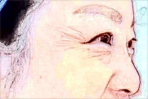 福州總醫(yī)院祛斑如何?福州總醫(yī)院祛斑價格是多少