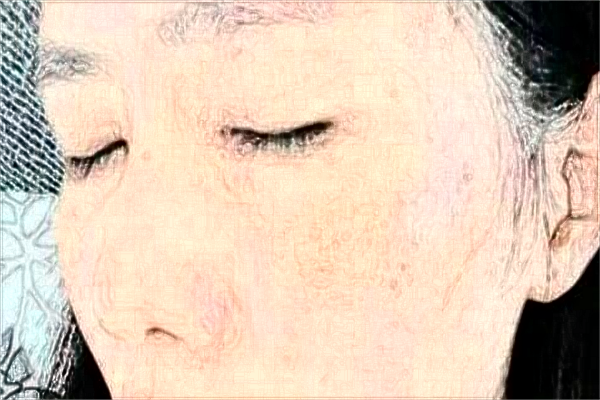 贛南醫(yī)學(xué)院第一附屬醫(yī)院祛痘印怎么樣?激光祛痘印價(jià)格2024