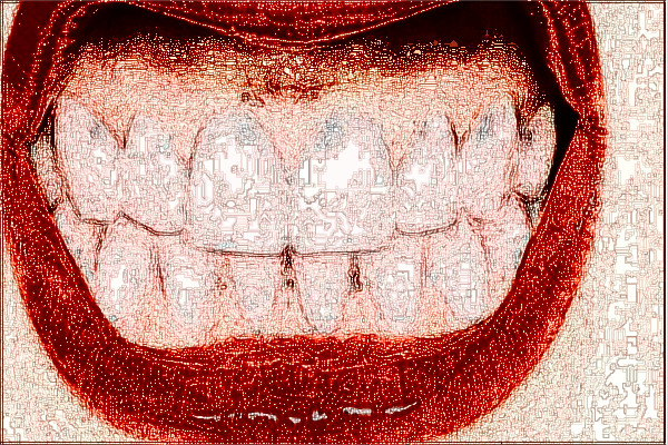 上海曙光醫(yī)院拔牙好不好【拔牙案例】