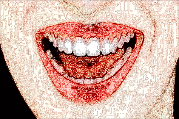 2024北大口腔醫(yī)院隱形矯正怎么樣_哪些醫(yī)生做的比較好