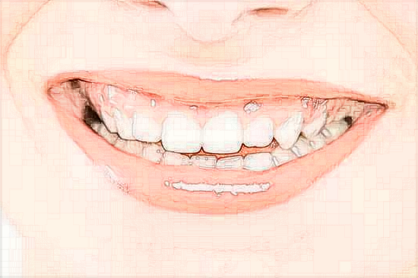 寧波市第一醫(yī)院牙齒矯正怎么樣、醫(yī)生做的好不好?