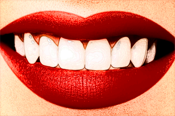 河北省口腔醫(yī)院補(bǔ)牙哪位醫(yī)生技術(shù)好【附補(bǔ)牙案例】