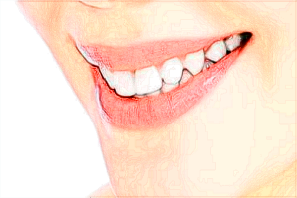 河北省口腔醫(yī)院種植牙技術怎么樣【種植牙案例】