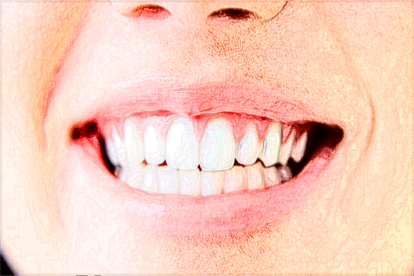 河北省口腔醫(yī)院正頜收費(fèi)標(biāo)準(zhǔn)_哪個醫(yī)生做的好