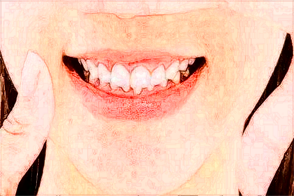 河北省口腔醫(yī)院正頜收費(fèi)標(biāo)準(zhǔn)_哪個醫(yī)生做的好