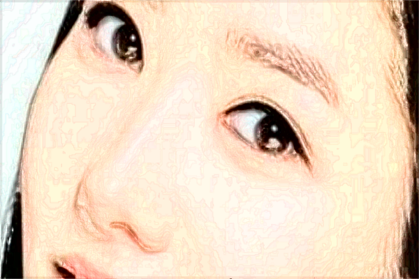 北京大學(xué)人民醫(yī)院激光祛斑怎么樣_激光祛斑的危害與效果