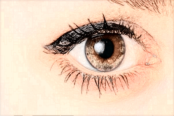 2024泰安市中醫(yī)二院眼角提升怎么樣?眼角提升價格公布