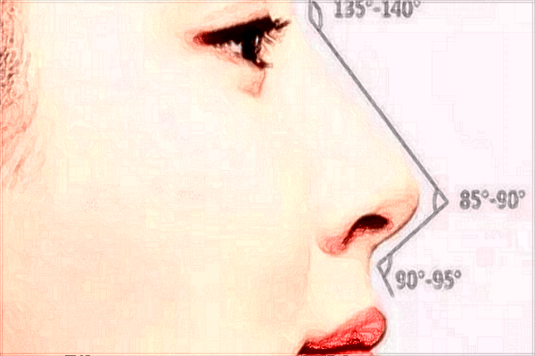 2024泰安市中醫(yī)二院做隆鼻價(jià)格_隆鼻可以只墊山根嗎