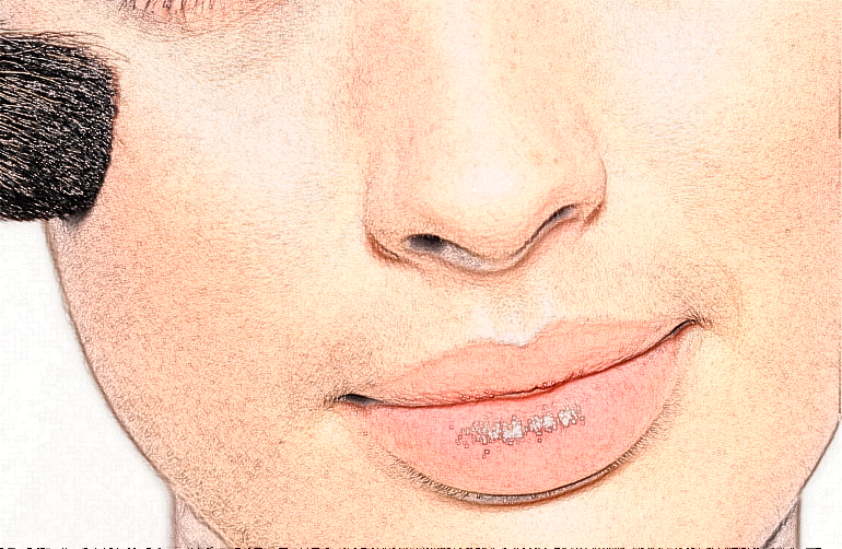 2024上海同濟醫(yī)院激光脫毛價格多少【激光脫毛案例】