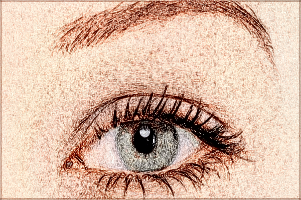 合肥市第一人民醫(yī)院激光祛斑價(jià)格多少_案例分享