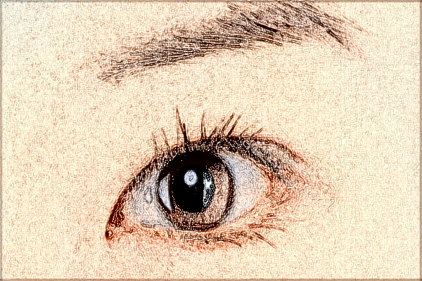 合肥市第一人民醫(yī)院激光祛斑價(jià)格多少_案例分享