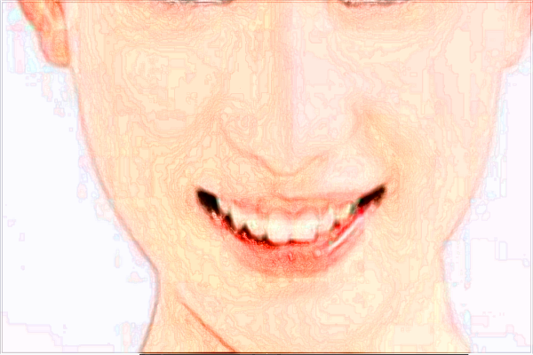 2024河北省中醫(yī)院祛雀斑價目表(價格表)公布_怎么樣