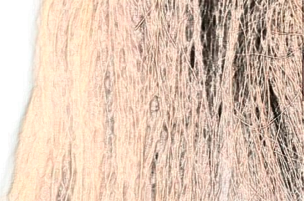 上海同濟醫(yī)院植發(fā)那個醫(yī)生做的好_做的怎么樣