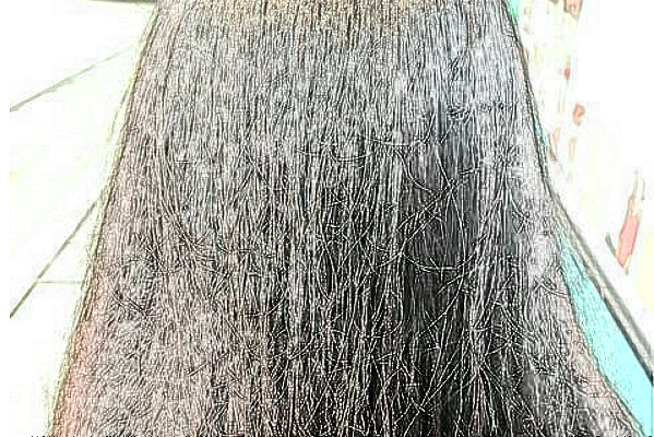 上海同濟醫(yī)院植發(fā)那個醫(yī)生做的好_做的怎么樣