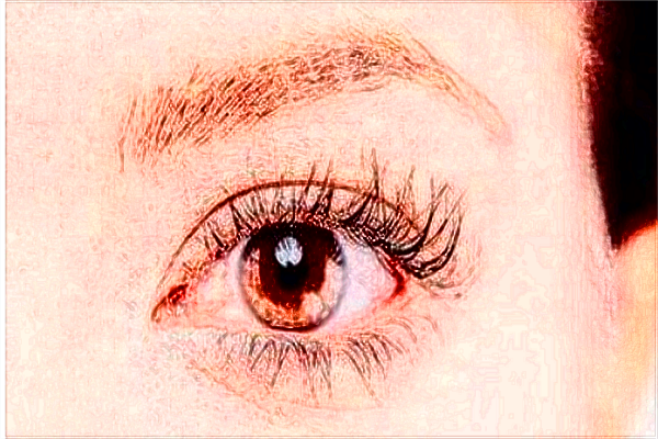 北大醫(yī)院割雙眼皮怎樣_哪個醫(yī)生做得好