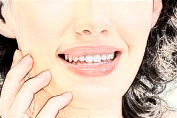 溫州醫(yī)學(xué)院附屬第一醫(yī)院去紅血絲價格多少_案例分享