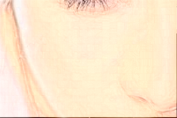 寧波李惠利醫(yī)院吸脂做的好嗎_哪位醫(yī)生做的好