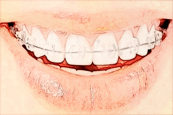 2024無錫市第二人民醫(yī)院口腔科哪個醫(yī)生好_價格貴不貴