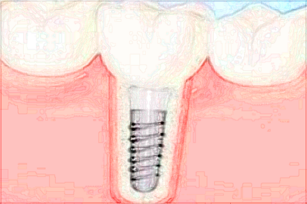 北京大學(xué)第一醫(yī)院口腔科王曉敏經(jīng)驗(yàn)怎么樣_技術(shù)好不好