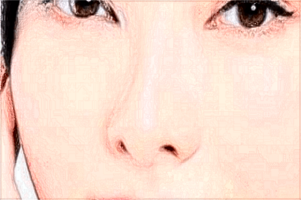 九江學(xué)院附屬醫(yī)院祛斑多少錢?2024激光祛斑價(jià)格?