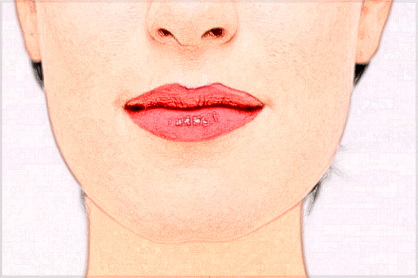 2024九江市第一醫(yī)院激光祛疤費(fèi)用?激光祛疤能徹底去掉嗎