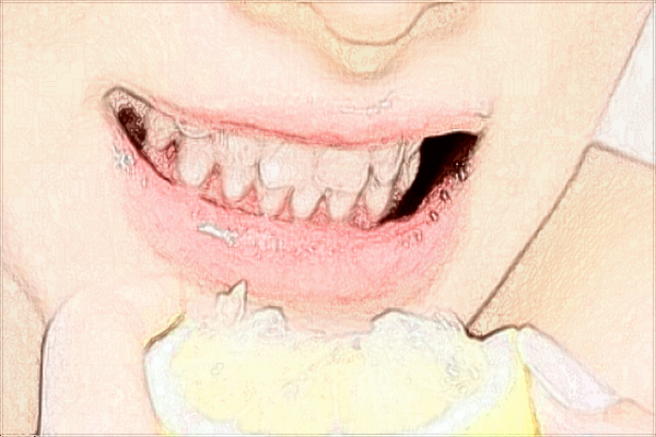 上海東方醫(yī)院種植牙怎么樣_大概需要多少錢(qián)