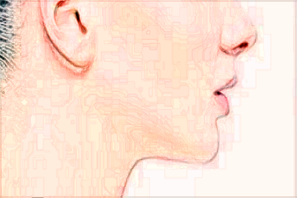 2024浙江省中醫(yī)院祛痘價目表(價格表)怎么樣