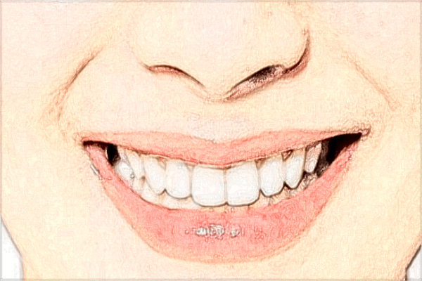 吉安市中心人民醫(yī)院口腔科種植牙口碑_收費(fèi)價(jià)格