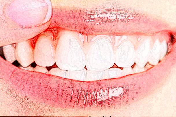 無錫市中醫(yī)院口腔科可以做正畸嗎_價格貴嗎