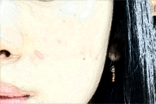 2024贛州市人民醫(yī)院祛斑多少錢?激光祛斑怎么樣