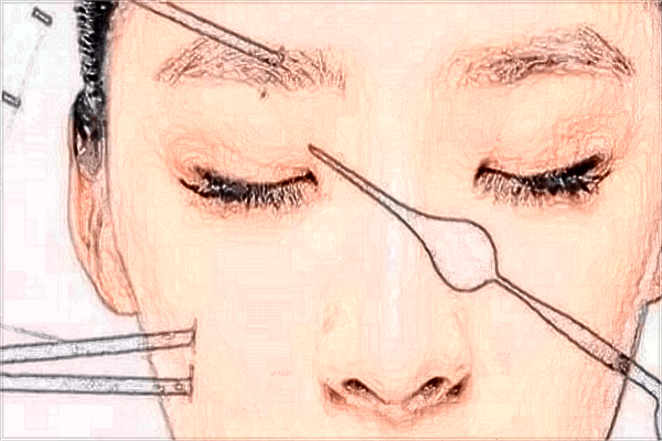 贛州市人民醫(yī)院激光祛斑掛哪個門診?激光祛斑多久能恢復(fù)