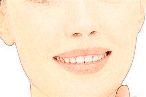 寧波李惠利醫(yī)院去痣價(jià)目表(價(jià)格表)怎么樣