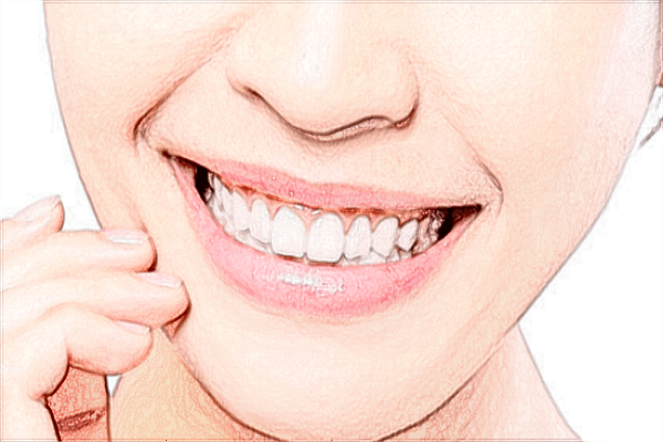 南充市中心醫(yī)院牙齒矯正做的怎么樣_牙齒矯正案例