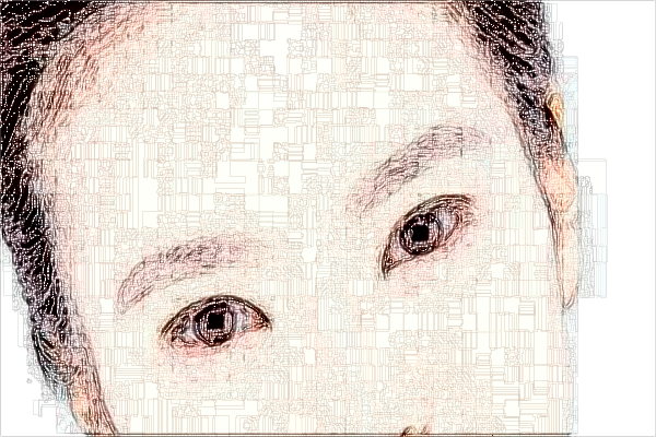 2024大連醫(yī)科大學附屬第一醫(yī)院去眼袋怎么樣_醫(yī)生技術好不好