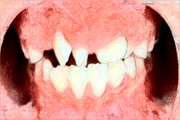 昆明中醫(yī)院牙科怎么樣?2024牙科收費價格?