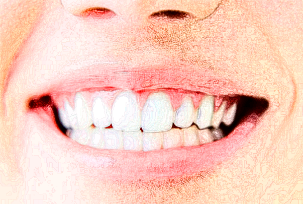 2024河北醫(yī)科大學(xué)口腔醫(yī)院全瓷牙價目表(價格表)怎么樣