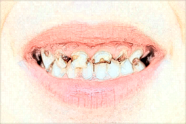 江西省口腔醫(yī)院口腔頜面外科費(fèi)用?口腔頜面外科診療范圍