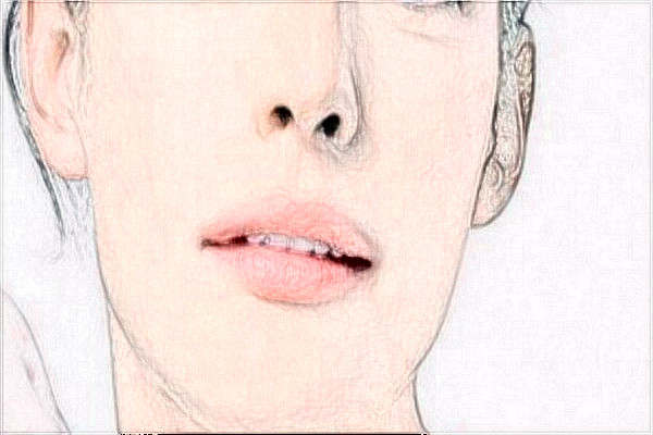 2024合肥市第二人民醫(yī)院光子嫩膚好不好_案例+價(jià)格