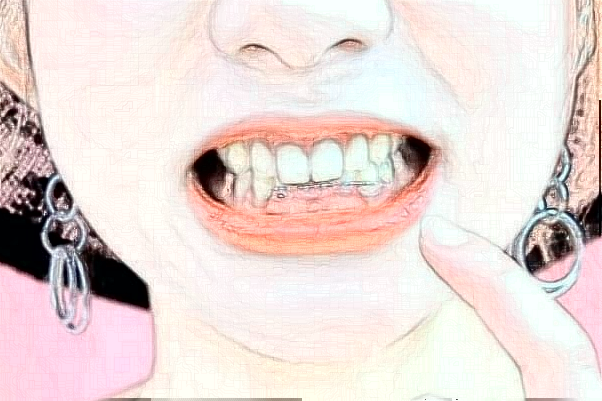 2024常州市第一人民醫(yī)院牙齒矯正價(jià)目表(價(jià)格表)怎么樣