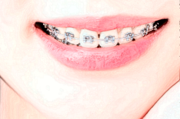 2024常州市第一人民醫(yī)院牙齒矯正價(jià)目表(價(jià)格表)怎么樣