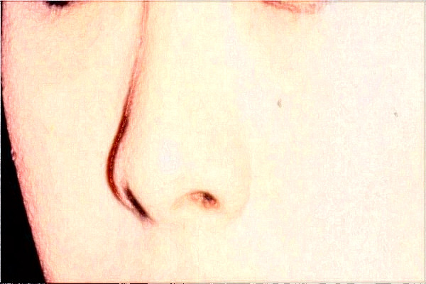 2024上海隆鼻整形醫(yī)院排名_醫(yī)院做的怎么樣