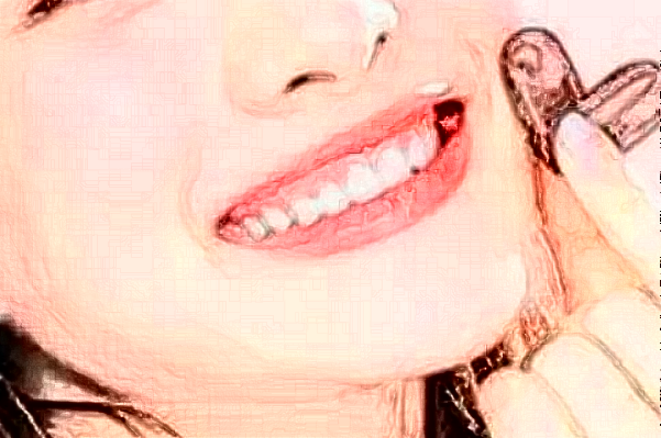 2024四川大學(xué)華西口腔醫(yī)院齙牙矯正怎么樣_哪個醫(yī)生做的不錯