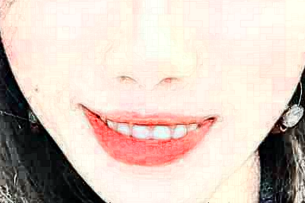 四川大學(xué)華西口腔醫(yī)院牙齒正畸好不好_哪個(gè)醫(yī)生做的不錯(cuò)