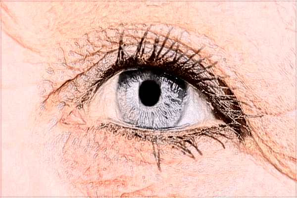 南昌大學第一附屬醫(yī)院近視激光手術(shù)怎么樣?近視激光手術(shù)價格