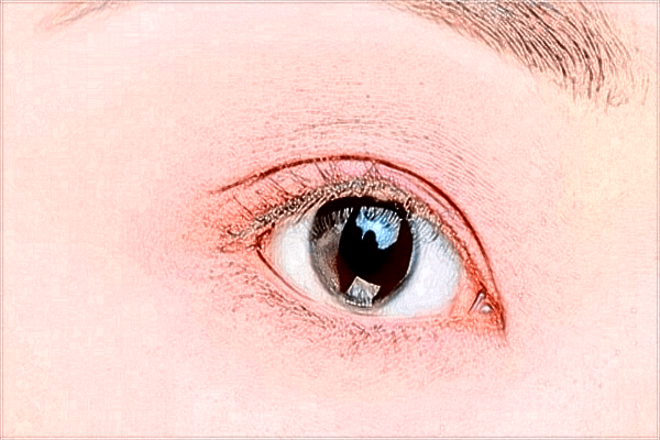 南昌大學第一附屬醫(yī)院近視激光手術(shù)怎么樣?近視激光手術(shù)價格