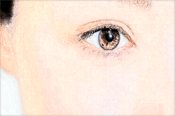 南昌大學(xué)第一附屬醫(yī)院近視眼手術(shù)好嗎?2024近視眼手術(shù)費用