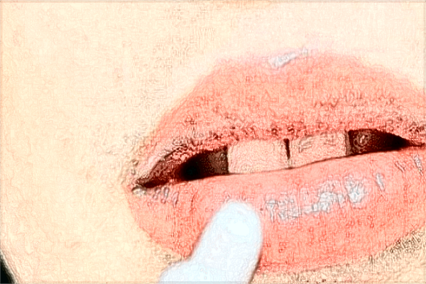 2024江西省口腔醫(yī)院隱適美價格?隱適美矯正牙齒利弊