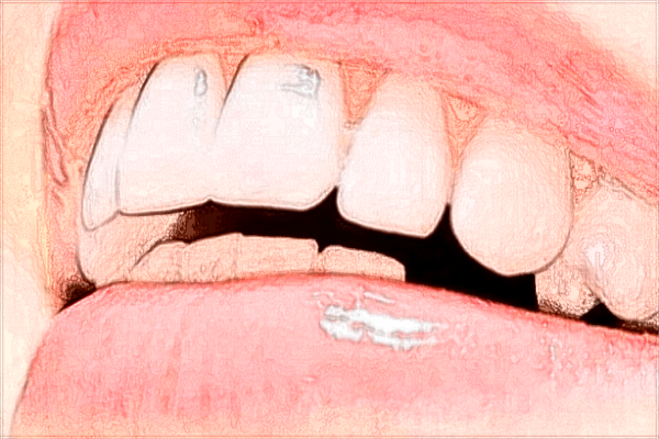 青島401醫(yī)院牙科怎么樣?青島401醫(yī)院牙科專家好嗎