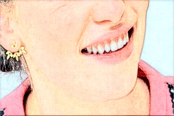 金華市中心醫(yī)院整牙做的好嗎_案例+價格